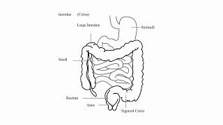 Acute Abdomen  Most common causes [upl. by Akcirahs172]