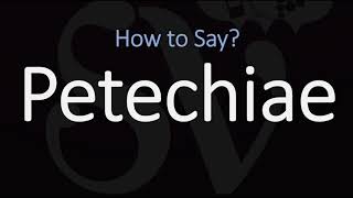 How to Pronounce Petechiae CORRECTLY Meaning amp Pronunciation [upl. by Ecela]