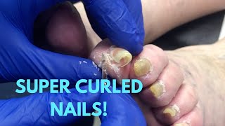 SUPER CURLED NAIL CARE [upl. by Halladba]