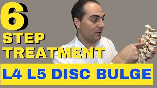 6 Step L4 L5 Disc Bulge Treatment L4 L5 Bulging Disc Treatment by Dr Walter Salubro [upl. by Bohrer]