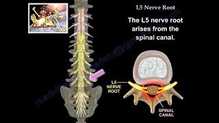 L5 Nerve Root  Everything You Need To Know  Dr Nabil Ebraheim [upl. by Yenahs]