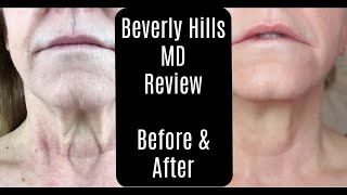 Beverly Hills MD Dermal Repair Complex—Lift and Firm Sculpting Cream—Before and After—AntiAging [upl. by Clair602]