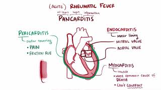 Rheumatic Fever amp Heart Disease  Part 17 🫀 [upl. by Ben331]