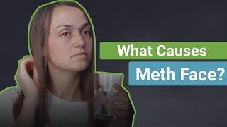 What Causes Meth Face [upl. by Nayb]