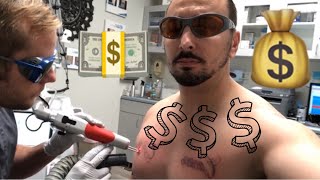 Laser Tattoo Removal COST 💰 HOW MUCH [upl. by Engedus]