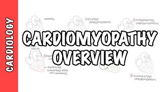 Cardiomyopathy Overview  types dilated hypertrophic restrictive pathophysiology and treatment [upl. by Moshell489]