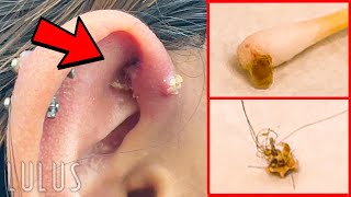 CLEAN Your Piercings Or THIS Can Happen…REMOVAL [upl. by Krongold]