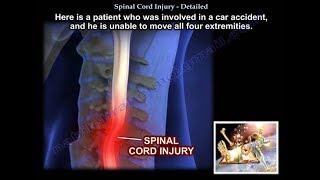 Spinal Cord Injury Detailed  Everything You Need To Know  Dr Nabil Ebraheim [upl. by Nahtnahoj]