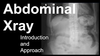 Abdominal Xray Introduction and Approach [upl. by Boorer]