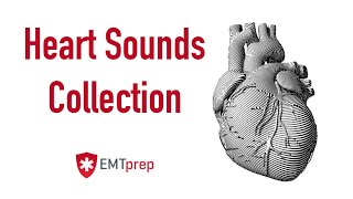 Heart Sounds Collection  EMTprepcom [upl. by Hgielram]