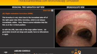 Bronchoscope simulator [upl. by Frankhouse819]