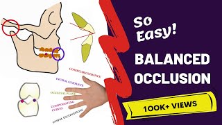 Balanced Occlusion Made Easy  PROSTHODONTICS [upl. by Yras]