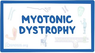 V2  EMG Online Series Myotonic Discharge triggered by needle movement [upl. by Athalla]