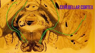 Purkinje cells in the cerebellum [upl. by Guimar]