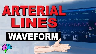 The Arterial Line Waveform EXPLAINED [upl. by Naval]