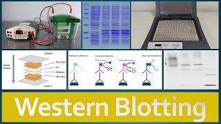 Western Blotting  Principle Procedure and Applications [upl. by Fonville]