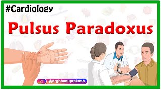 Pulsus Paradoxus  Examination of the arterial pulse  Cardiology USMLE [upl. by Halyahs]