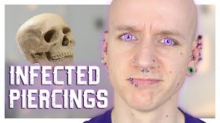 Infected Piercings amp How To Heal Them  Piercing FAQ 21  Roly [upl. by Penney]