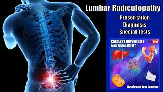 Lumbar Radiculopathies  Presentation Diagnosis amp Special Tests [upl. by Elamef208]