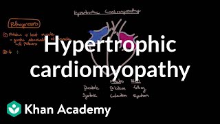 Hypertrophic cardiomyopathy Pathophysiology and diagnosis  NCLEXRN  Khan Academy [upl. by Ulu441]