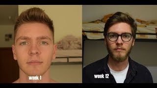 Patchy blonde beard Time Lapse  3 Months [upl. by Yci]