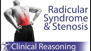 Lumbar Radicular Syndrome vs Intermittent Neurogenic ClaudicationStenosis [upl. by Alie]