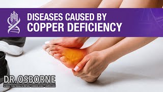 Diseases Caused by Copper Deficiency [upl. by Wayolle]