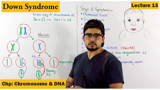 Downs Syndrome  A Genetic Disorder  Lecture 13 [upl. by Peace]