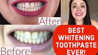 BEST WHITENING TOOTHPASTE EVER REVIEW Crest 3D White Brilliance [upl. by Greff]