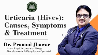 Urticaria Hives  CausesSymptoms amp Treatment [upl. by Chloras153]