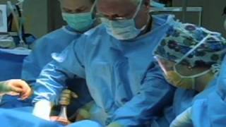 Safe Exercises After A Cesarean 46 Weeks PostOp 2 Full Video [upl. by Ajroj]