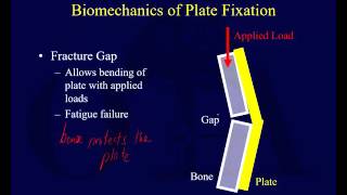 Orthopaedic Implants 1 [upl. by Boylston328]