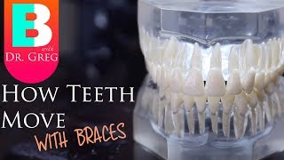 BRACES EXPLAINED How Teeth Move  Braces Work [upl. by Dahsraf319]