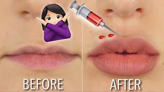 HOW TO GET FULLER LIPS AT HOME  NO FILLER  DIY  Hannah Dorman [upl. by Anthiathia]