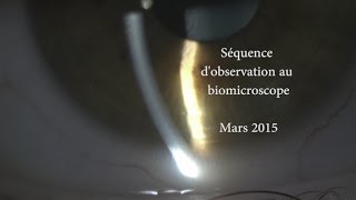 Biomicroscope  17 étapes dobservation [upl. by Droffats]