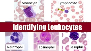 Identifying Leukocytes [upl. by Tortosa]