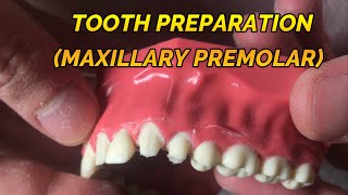 CROWN PREPARATION TUTORIAL MAXILLARY PREMOLAR [upl. by Anauq948]