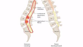 Lumbar Radiculopathy for the USMLE Step 1 [upl. by Rednirah506]