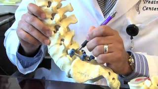 Surgical Procedures  Lumbar Laminectomy amp Discectomy [upl. by Nerw]