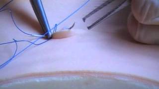 Subcuticular Suture Technique [upl. by Brod]