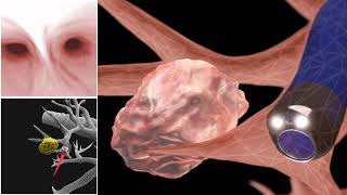 Flexible Bronchoscopy Introduction 2  Handling [upl. by Ruphina922]