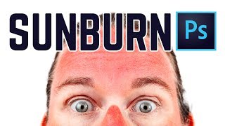 How to Get Rid of Sunburn almost Instantly PHOTOSHOP [upl. by Neelac]