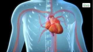 How It Works Transcarotid Artery Revascularization TCAR [upl. by Nimajneb]