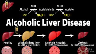 Alcoholic Liver Disease Animation [upl. by Babb]