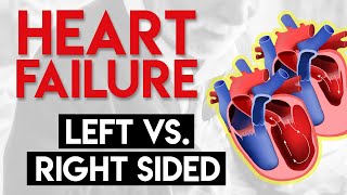 Left vs Right Heart Failure  Heart Failure Part 3 [upl. by Jandy]