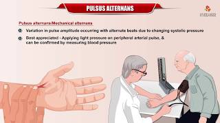 Pulses Alternans  Definition Etiology and Mechanism  Internal medicine  Usmle Cardiology [upl. by Aubree620]