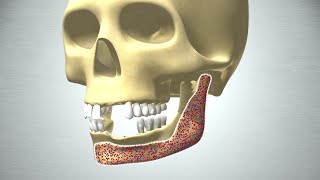 Revolution in Bone Regeneration [upl. by Richardo]