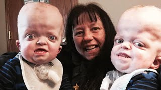 DAY IN THE LIFE OF CALI PARENTS CARE FOR MEDICAL NEEDS CHILD WITH NO NURSES PFEIFFER SYNDROME [upl. by Francklyn]