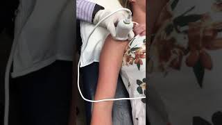 Bicep Tendon Injection  Elite Sports Medicine  Lethbridge [upl. by Loraine]