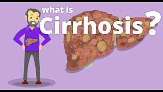 Cirrhosis of Liver  Pathology [upl. by Berty]